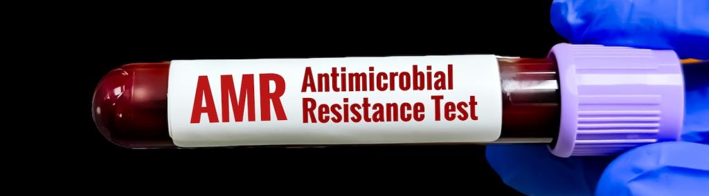 Image showing an antimicrobial resistance test