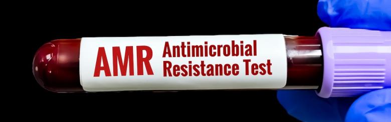 Image showing an antimicrobial resistance test